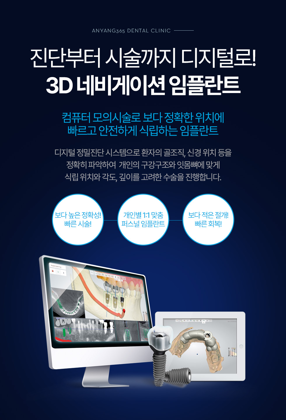진단부터 시술까지 디지털로! 3D 네비게이션 임플란트