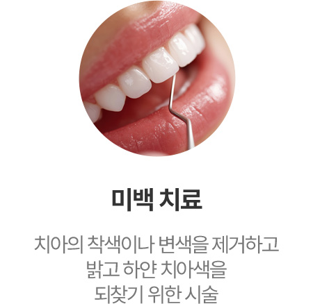 미백 치료