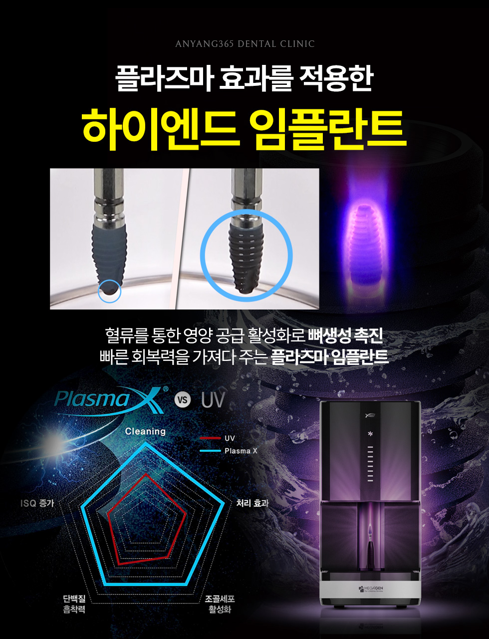 플라즈마 효과를 적용한 하이엔드 임플란트