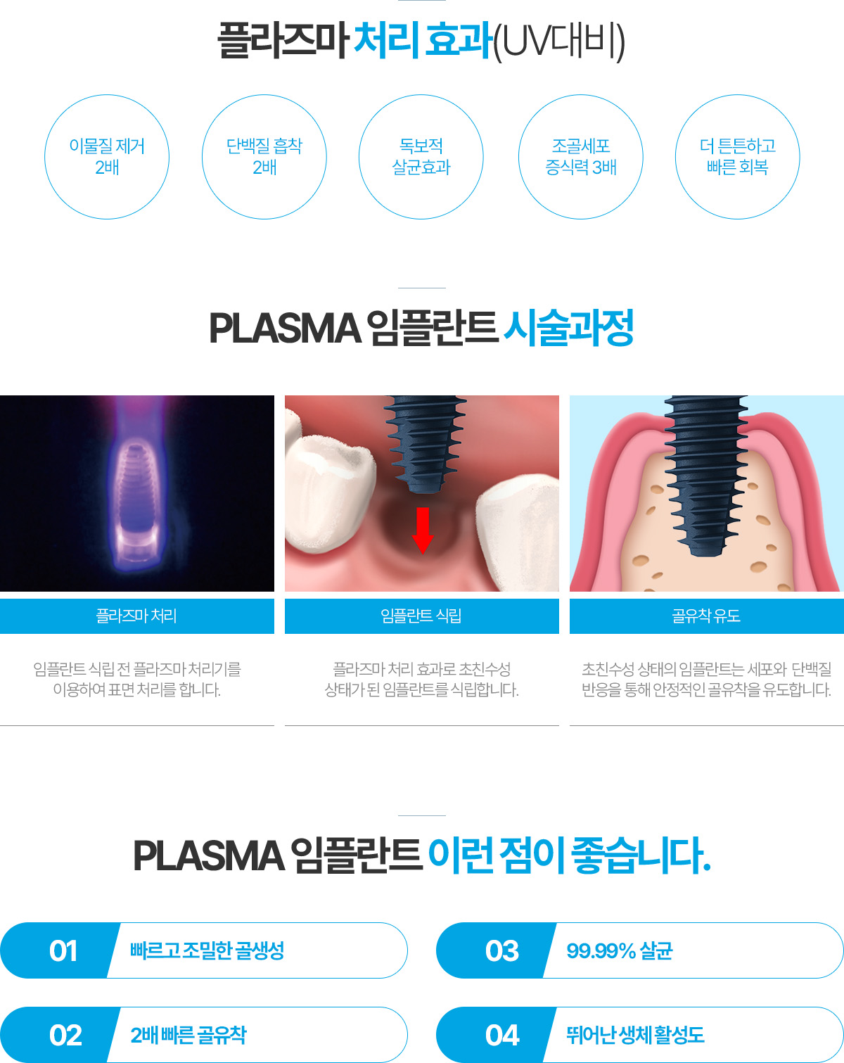 플라즈마 처리 효과(UV대비), PLASMA 임플란트 시술과정, PLASMA 임플란트 이런 점이 좋습니다.