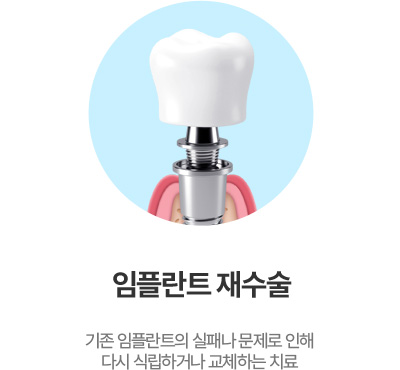 임플란트 재수술