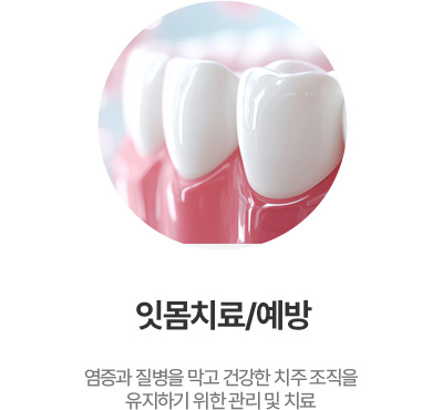 잇몸치료/예방